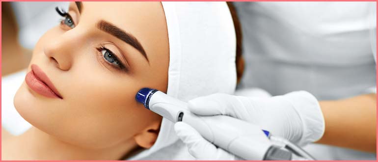 microneedling